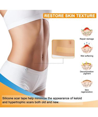 Silicone Scar Sheets & Gel Tape Roll - Reusable Waterproof Scar Removal for C-Section Keloid & Stretch Marks - 1.6 x 59 - Buy Online on GoSupps.com
