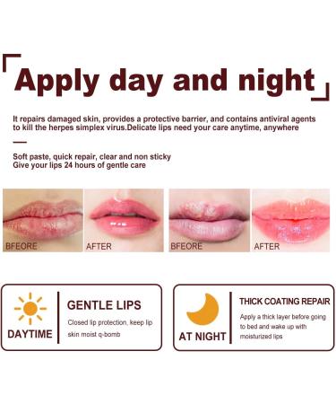 Lip Balm Set Moisturizing Lip Care Set Fruit Flavor Lip Balm Stick Lip Moisturiser for Lip Repair Hydrating Lip Balm for Dry Lips Chapped Lips Treatment Lip Repair Balm Lip Balm Lipstick(Blueberry) Blueberry Blue - Buy Online on GoSupps.com