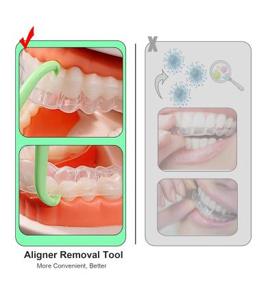 Aligner Removal Tool Portable Clear Aligner Removal Tool for Invisalign Removable Retainers Braces Aligners Remove Hook Pull Tool (8PCS) - Buy Online on GoSupps.com