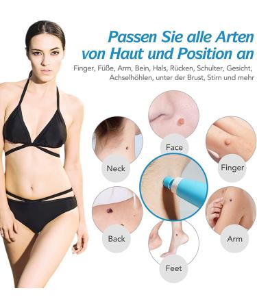 Skin Tags Treatment Nolisia Skin Tag Treatment Anti Skin Tags Skin Wart Removal Device 2-8mm 2 in 1 for Removing Face Body Warts - Buy Online on GoSupps.com