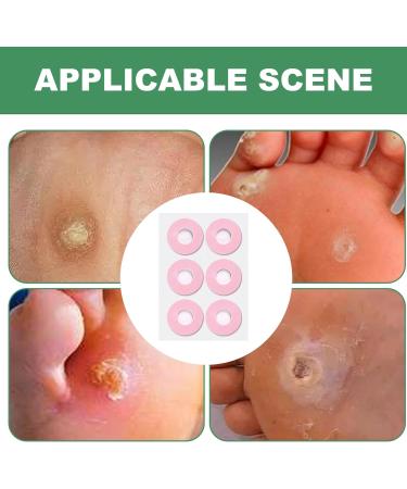 Round Corn Cushions - Corn Cushion Foam Pads - Corn Patches Foot Toes Soft Foam Callus Cushions Waterproof Corn Protectors Adhesive Foot Care Cushions Gentle Support - Buy Online on GoSupps.com
