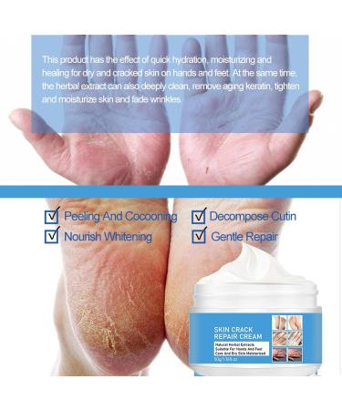 Foot Cream Callus Remover for Dry And Hard Skin Foot Nourishing Cream Deep Moisturizing Callus Remover and Soften Hard Skin Remover for Hand and Foot Care 50G - Buy Online on GoSupps.com
