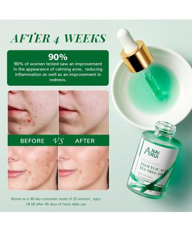 ANAI RUI Acne Face Oil Tea Tree Oil & Salicylic Acid for Acne Prone Skin Soothing Redness Relief - 1Fl.OZ - Buy Online on GoSupps.com