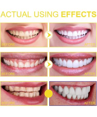 Propolis Smile Mouthwash - Total Care for Teeth & Gum Health | Refreshing Breath & Deep Cleaning (2 pcs) - Buy Online on GoSupps.com