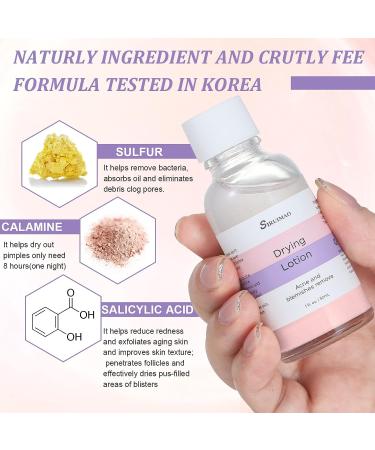 SIRUIMAO Stubborn Acne Drying Lotion - Overnight Acne Spot Treatment for Face & Body - 1 Fl Oz (Pack of 1) - Buy Online on GoSupps.com