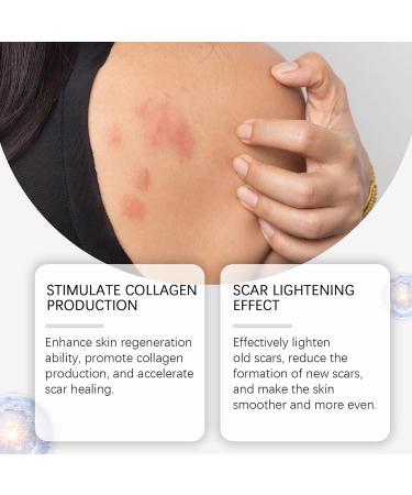 Antiscar cream 50 g reduces the visibility of scars care for face body caesarean section wounds burns old and new scars - Buy Online on GoSupps.com