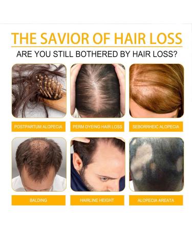 Nourishing Hair Fertilizer | Biotin for Hair Growth | Hair Repair Lotion | Hair Growth and Repair Lotion Moisturizing Hair Lotion Hair Revitalizer for Damaged Hair - Buy Online on GoSupps.com