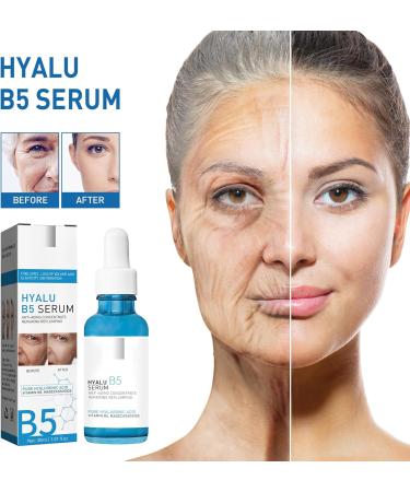 Hyaluronic Acid & B5 Serum - Dark Spot Remover for Face - Hyaluronic Acid Serum for Face for Hydrated - Anti Aging Serum Targets Fine Lines & Wrinkle - Firming and Plumping of Skin All Skin Types (B5) - Buy Online on GoSupps.com