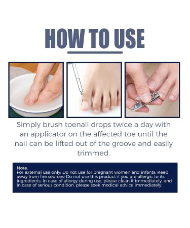 Paronychia Oil for Ingrown Toenail Treatment - Nail Renewal Liquid for Damaged Nails (2 Pcs) - Buy Online on GoSupps.com