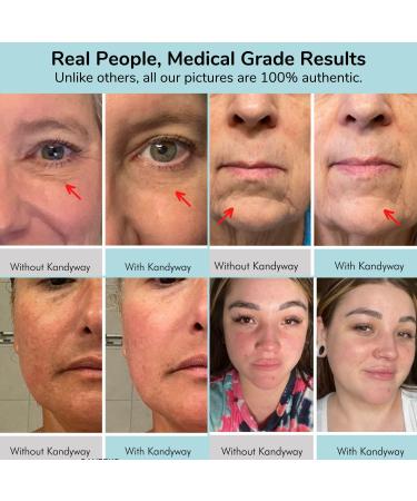 Red Light Therapy Mask - FDA Cleared Medical Grade LED Device for Wrinkle Reduction Scarring Treatment and Skin Tone Improvement - Buy Online on GoSupps.com