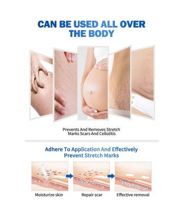 90pcs Pregnancy Stretch Marks Essential Oil | Skin Care & Beauty - Abdominal Massage Oil for Effective Stretch Mark Removal - Buy Online on GoSupps.com
