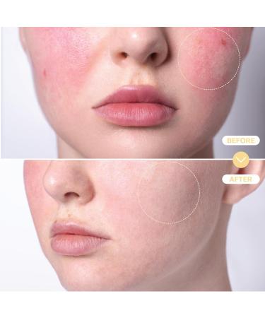 BASE LABORATORIES Hypochlorous Acid Spray for Face & Skin - Travel Size - Facial Toner Spray & Cleaner - Skin Repair Solution helps reduce redness, Irritations, acne - HOCL Molecule Spray 2oz 2 Fl Oz (Pack of 1) - Buy Online on GoSupps.com