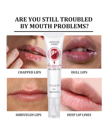 Jinshane Lip Serum by Vitamin Extract Lip Lightening for Dark Lips Lip Balm Dark Lip Treatment for for Smokers and Non-smokers Lip Brightener for Dark Lips Fade Cream 2Paack - Buy Online on GoSupps.com
