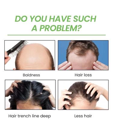 Essential Oil for Hair Density & Growth - 30ml Aibyks Natural Wild Hair Growth Oil - Buy Online on GoSupps.com