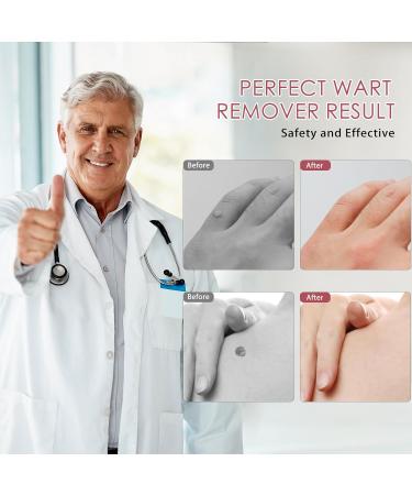 Wart Remover Liquid - Fast Acting Salicylic Acid Solution for Common & Plantar Warts | 0.68 Fl Oz | Safe & Natural Treatment - Buy Online on GoSupps.com