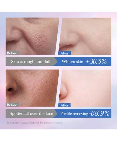 Dark Spot Correcting Glow Serum Niacinamide Serum Brightening Serum - Dark Spot Remover for Face with Alpha Arbutin Serum & Ceramide - Reduces Dullness Hydrates & Repairs Skin Face Serum for Women - Buy Online on GoSupps.com