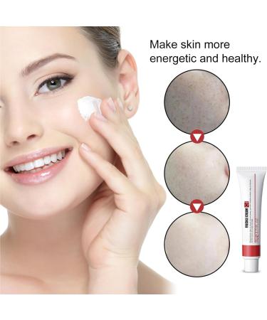 Dark Spot Remover for Face & Body Age Spot Remover for Face Spot Cream Dark Spot Corrector Hyperpigmentation Treatment Freckle Remover Cream Formulated with Nicotinamide Vitamin E Glycerol - Buy Online on GoSupps.com