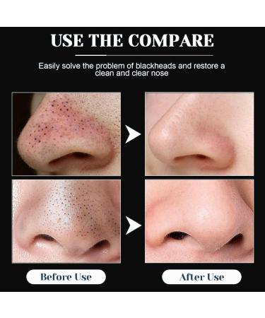 40 Blackhead Strips - Intensive Pore Cleaning for Clear Radiant Skin | Remove Blackheads with Effective Nasal Pore Strips - Buy Online on GoSupps.com