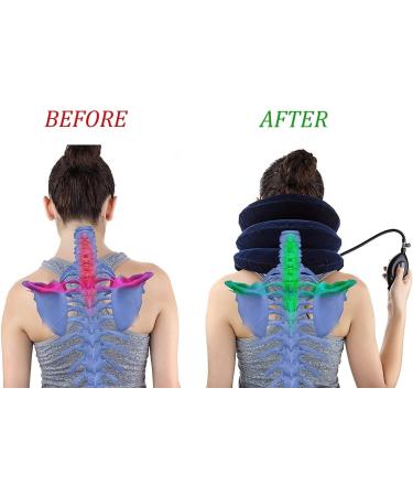 Inflatable Neck Stretcher Collar Cervical Neck Traction Device Neck Cervical Brace Collar Pillow for One Size Fits All Necks - Buy Online on GoSupps.com