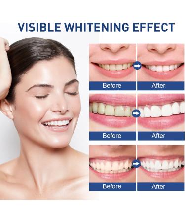 2-Piece 5ml Professional Tooth Whitening Color - Remove Stains & Achieve a Shiny Smile - Buy Online on GoSupps.com