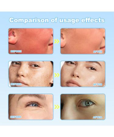 Sun UV Face Anti-Age SPF 50 Cream Face Sunscreen SPF 50 Sensitive Sun Cream for Face Powerful Ingredients with Vitamin C Hyaluronic Acid Niacinamide Deep Hydration Calm Soothing Repair Skin - Buy Online on GoSupps.com