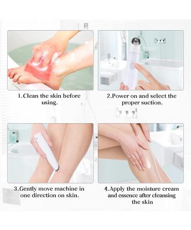NEWDERMO Body Microdermabrasion Exfoliator Machine - Professional Suction Diamond Dermabrasion Device - Home Body Treatment Tool - Buy Online on GoSupps.com