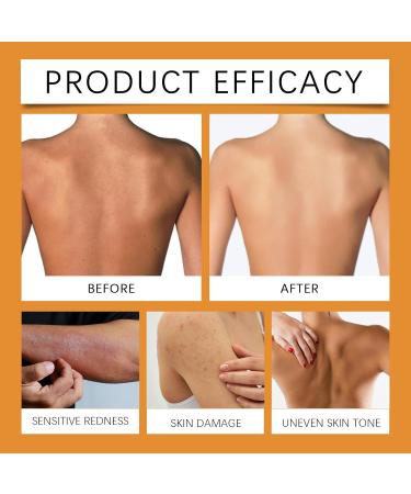 Calendula Turmeric Soap Brightening soap for natural skin glow calendula turmeric facial cleanser Natural turmeric soap for face and body oil control and deep cleansing - Buy Online on GoSupps.com