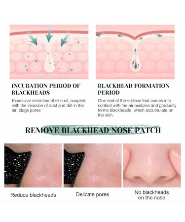 40 Blackhead Strips - Intensive Pore Cleaning for Clear Radiant Skin | Remove Blackheads with Effective Nasal Pore Strips - Buy Online on GoSupps.com