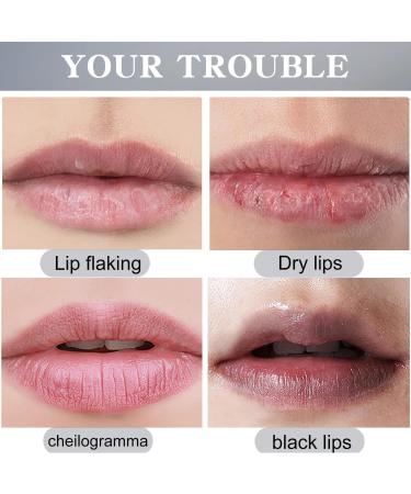 Lip Lightening For Dark Lips Lip Balm Lips Pink Bleaching Cream Balm Long Lasting Moisturizing Lip Care Cream Cruelty Free lip cream for Repairs Cracks and Nourishes Lips(0.2oz) - Buy Online on GoSupps.com