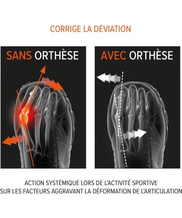 Epity Protection Pied Hallux Valgus - Comfort & Support for Bunion Relief | International Shipping Available - Buy Online on GoSupps.com