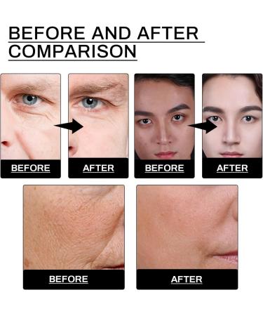 Mens Anti Aging Face Cream Mens Face Cream Mens Moisturiser Face Mens Anti Wrinkle Face Cream Mens Anti Aging Moisturiser Skin Tightening Men's Moisturiser Reduce Fine Lines Firming Men Skincare - Buy Online on GoSupps.com