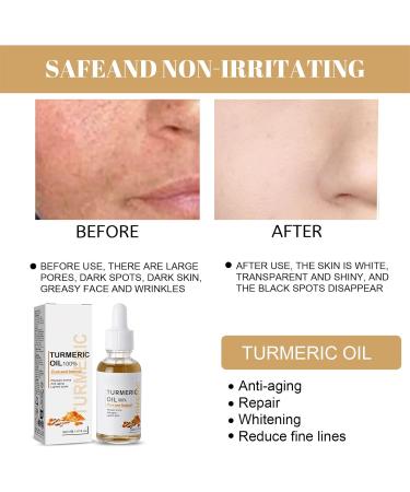 Zynewa Turmeric Oil Facial Care Serum turmeric care serum moisturizing facial care gentle skin nourishment for soft and radiant skin - Buy Online on GoSupps.com
