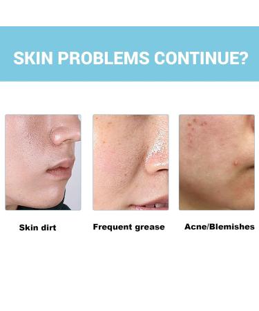 Deep Cleansing Facial Foam - Oil Control Pore Refining & Skin Tightening - Unclog Pores & Brighten Skin(2PCS) - Buy Online on GoSupps.com
