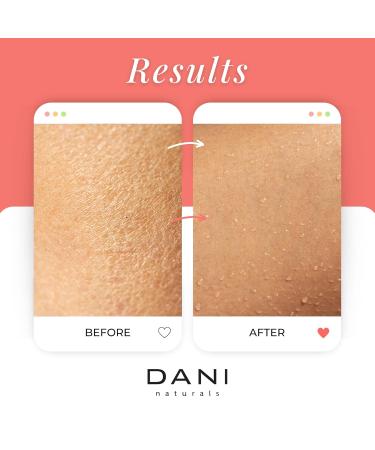 Pure & Gentle Exfoliating Sugar Scrub - DANI Naturals Tropical Coconut Hibiscus | Organic Cane Sugar & Shea Butter Body Polish 14 oz - Best for Smooth Skin - Buy Online on GoSupps.com