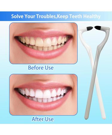 4-Piece Tartar Remover Set | DIY Teeth Stain & Plaque Removal | Dental Tray for Discoloration - Buy Online on GoSupps.com