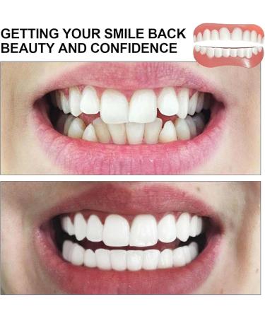 1 Pair Fake Dental Braces Cosmetic Denture Removable Upper and Lower Dental Veneer Perfect Smile Denture False Tooth Temporary Tooth Cover for Men and Women - Buy Online on GoSupps.com