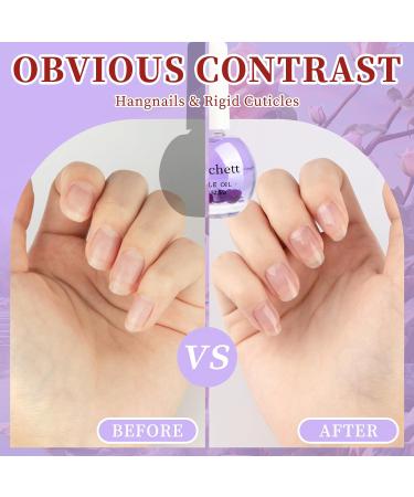 Sweet Almond Cuticle Oil for Nail Repair & Growth - Nail Strengthener 15ml (Lavender) - Buy Online on GoSupps.com