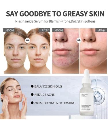 10% Niacinamide Serum + 1% Zinc Serum Niacinamide Face Serum Moisturiser Face Face Serum Minimises Pore Anti Aging Serum for Face Brightening Serum Tackles Blemishes Niacinamide Brightening Toner - Buy Online on GoSupps.com