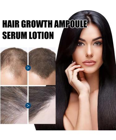 Katutude Hair Regrowth Essence Herbal Hair Growth Serum 40ML Natural Hair Regrowth Lotion Nourishing Serum for Women Men Prevent Hair Loss and Promote Stronger Longer Hair (5 Pack) - Buy Online on GoSupps.com