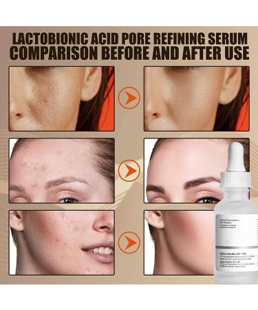Hyaluronic Acid Serum Dark Spot Remover for Face Lightweight Face Serum Softens & Hydrates Skin for All Skin Types Skin Care - Buy Online on GoSupps.com