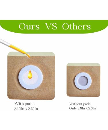 60Pcs Castor Oil Patches Disposable Castor Oil Belly Button Patch Upgrade Anti Leakage Pads Skin Color Organic Cotton Patches (Oil Not Included) - Buy Online on GoSupps.com