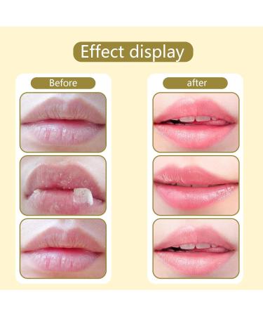 XdealCozyxc Honey Strawberry Watermelon lip balm Set Bee Balm Lip Mask Moisturizing Care Lighten Dark Lip Color Reduce Lip Lines - Buy Online on GoSupps.com