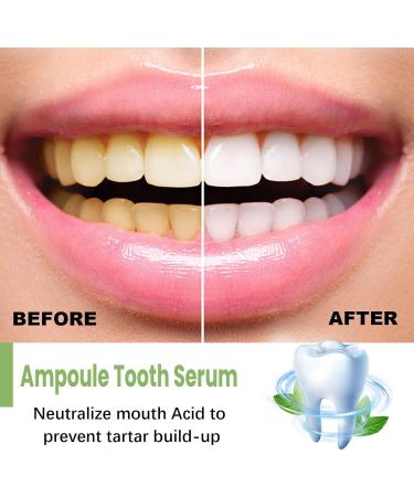 Ambullen Tooth Serum - Whitening & Gum Repair Essence Ampoules (5PC) for Healthier Teeth & Tartar Removal - Buy Online on GoSupps.com