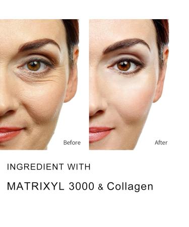 5% Collagen Serum Anti Aging Serum for Women with Collagen and Matrixyl 3000 Skin Tightening Helps Lift Plump & Firm Sagging Skin for Face 1 Fl Oz - Buy Online on GoSupps.com