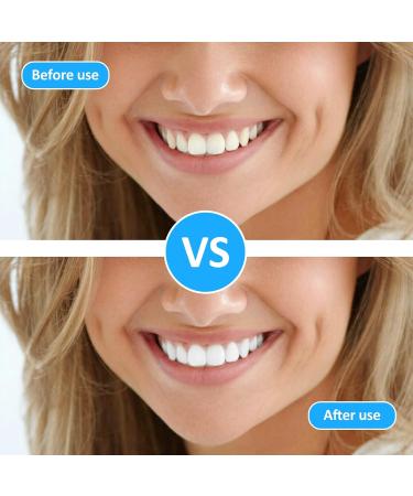 100 Interdental Brushes for Superior Oral Hygiene | Intermediate Brushing Tool with Lid - Perfect for Home Use - Buy Online on GoSupps.com