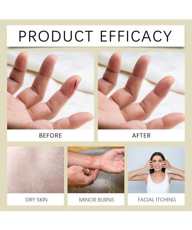 ARCHIDATE Beef Tallow for Skin Whipped Tallow Cream Face and Body Deep Hydration Reduce Fine Lines Repair Skin Barrier Organic Natural Fast Absorption Grass Fed Beef Tallow for All Skin Types - Buy Online on GoSupps.com