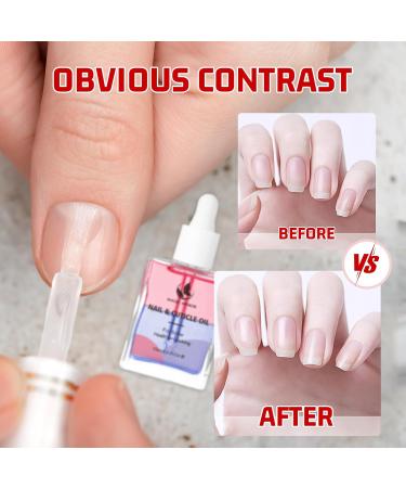 MAGIC ARMOR Huile pour cuticules pour ongles 15 ml - Hydrate et renforce le jojoba et la vitamine E - Hydrate et r pare et renforce les cuticules et les ongles - Pr vient les ongles - Buy Online on GoSupps.com