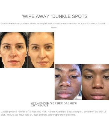 Fenayuu Dark Spot Correction Brightening Dark Spot Correction for Face and Body 30ml Effective Moisturizer for Face Armpits and Legs All Skin Types - Buy Online on GoSupps.com