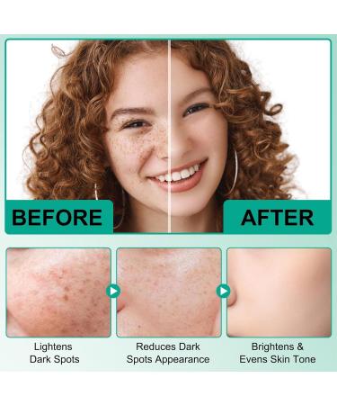 Dark Spot Correcting Glow Serum Korean Dark Spot Correction Serum Skincare Glow Intense Eclaircissant Anti-Stain Cream With Retinol And Hyaluronic Acid Lightening Cream (1) - Buy Online on GoSupps.com