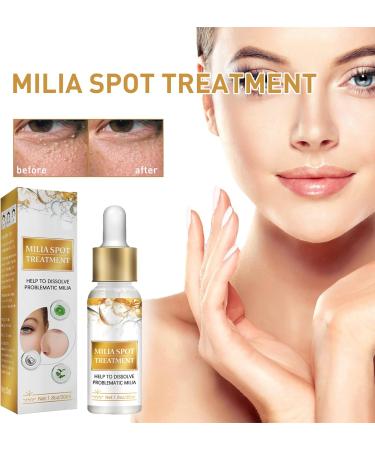Milia Removal Face Serums Milia Spot Remover Milia Remover Milia Spot Serum for Face Milia Serum for Face Milia Spot Serum Helps to Ruduce Milia Reduces Bags Saggy Skin & Puffy Eyes 30ML - Buy Online on GoSupps.com